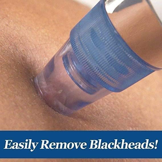 Blackhead Remover